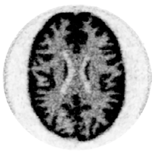 3D Hoffman brain phantom, ICS events only, reconstructed without recovery (CoG positioning)
