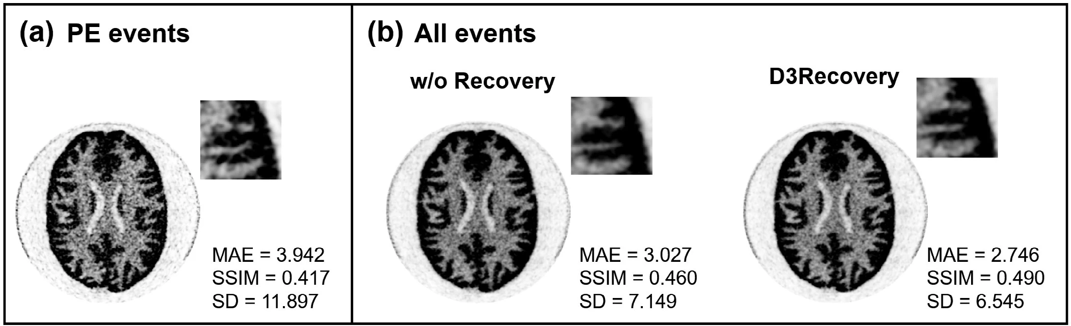 Hoffman phantom reconstructed from 10% of the data. Photoelectric events only give MAE 3.942, SSIM 0.417 and SD 11.897. All events without recovery give MAE 3.027, SSIM 0.460 and SD 7.149. All events with D3Recovery give MAE 2.746, SSIM 0.490 and SD 6.545.